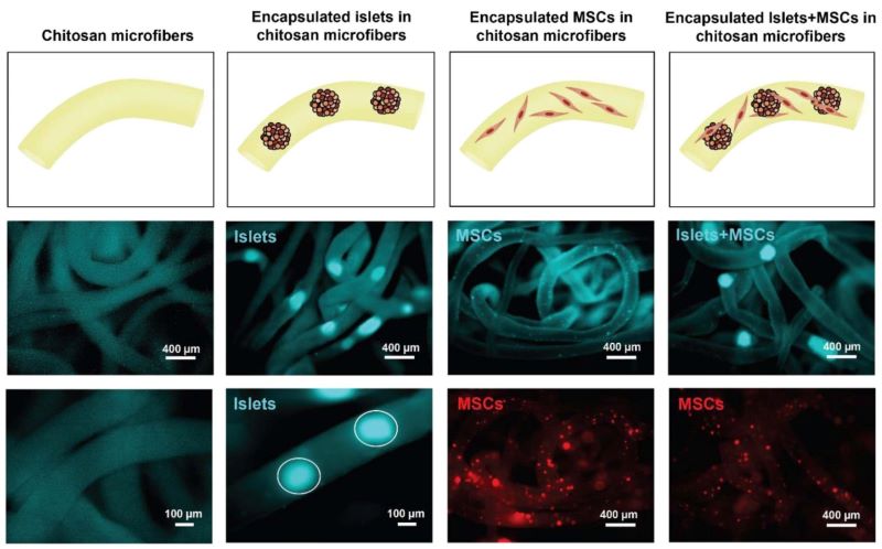 Microfluidically Fabricated Fibres Containing Pancreatic Islets And Mesenchymal Stromal Cells Improve Longevity And Sustained Normoglycemia In Diabetic Rats